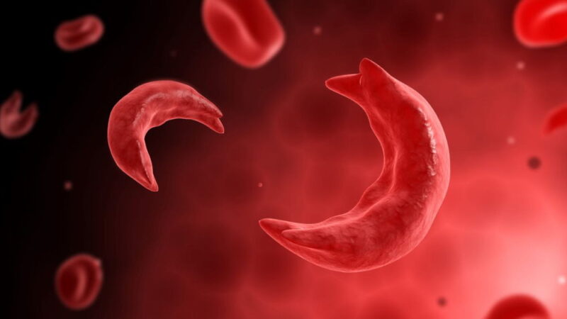National Sickle Cell Awareness Month - September