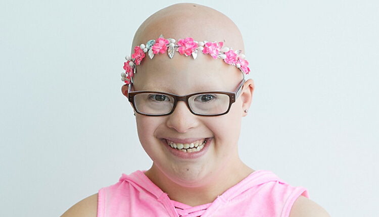 Children With Alopecia Day - April 14