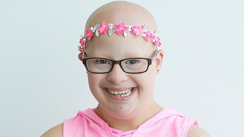 Children With Alopecia Day - April 14