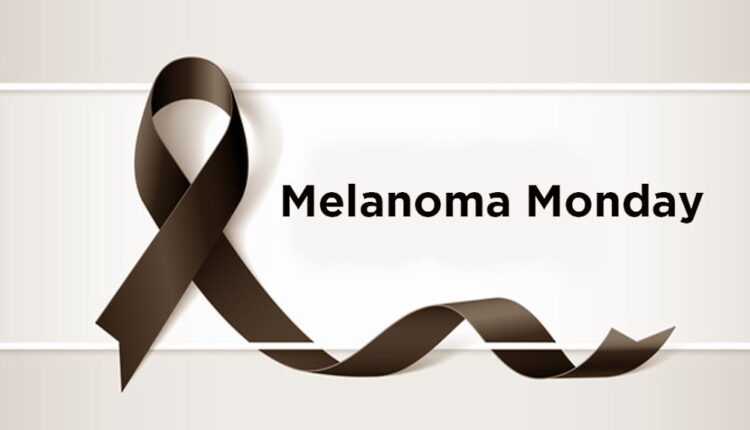 Melanoma Monday - May