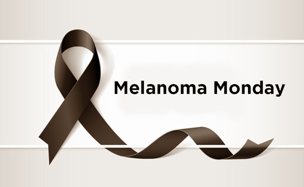 Melanoma Monday - May