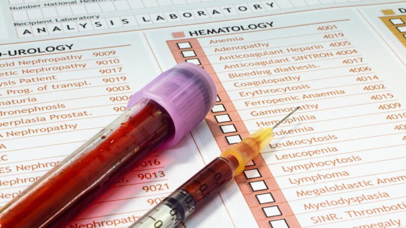 National Hepatitis Testing Day - May 19