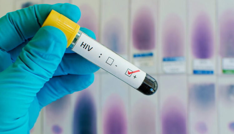 National HIV Testing Day - June 27