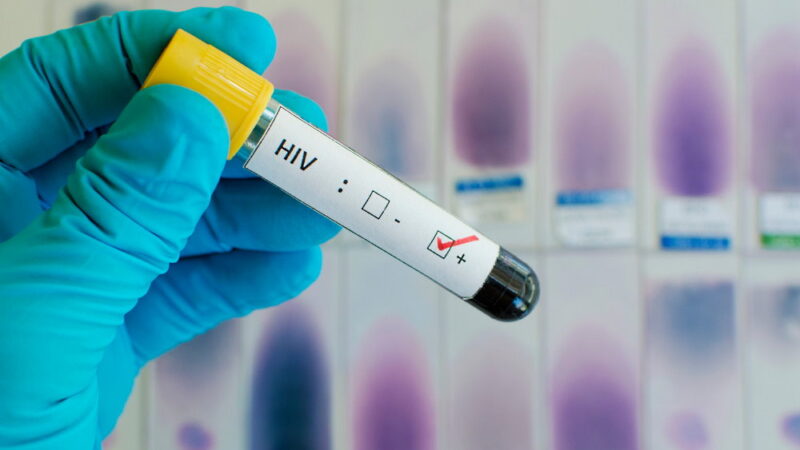 National HIV Testing Day - June 27