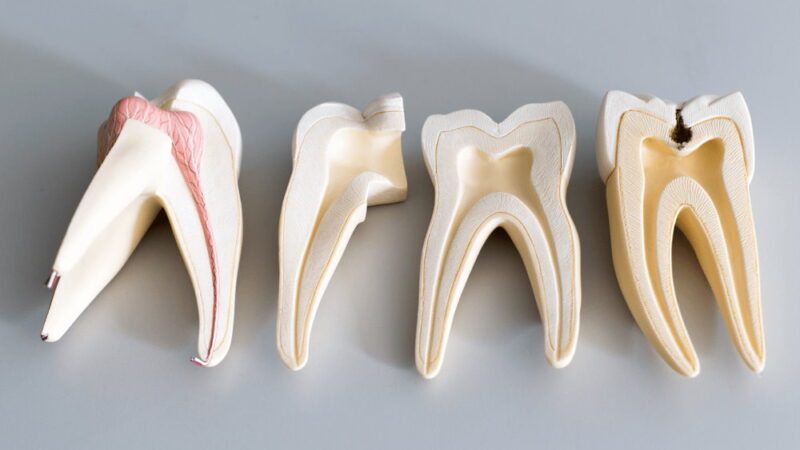 National Root Canal Appreciation Day - May