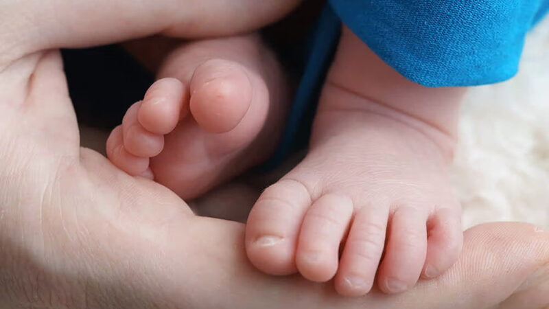 World Clubfoot Day - June 3