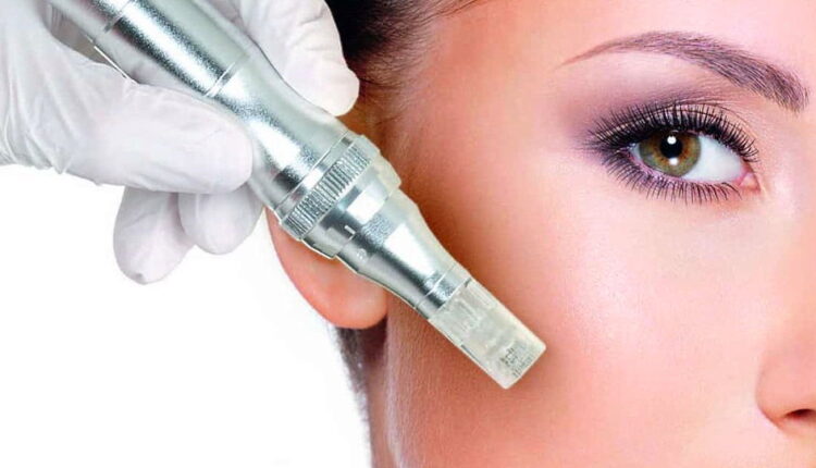 National Microneedling Day - October 26