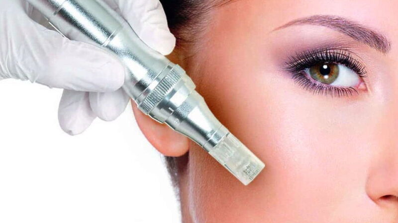 National Microneedling Day - October 26