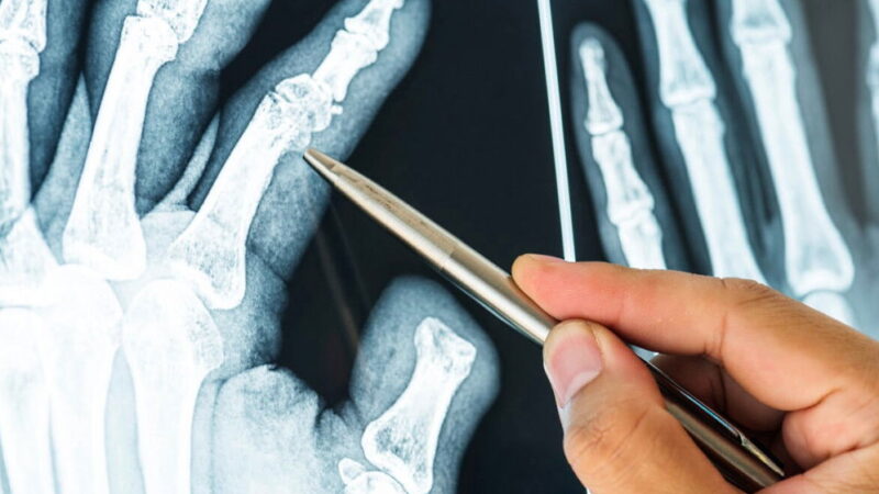 World Radiography Day - November 8