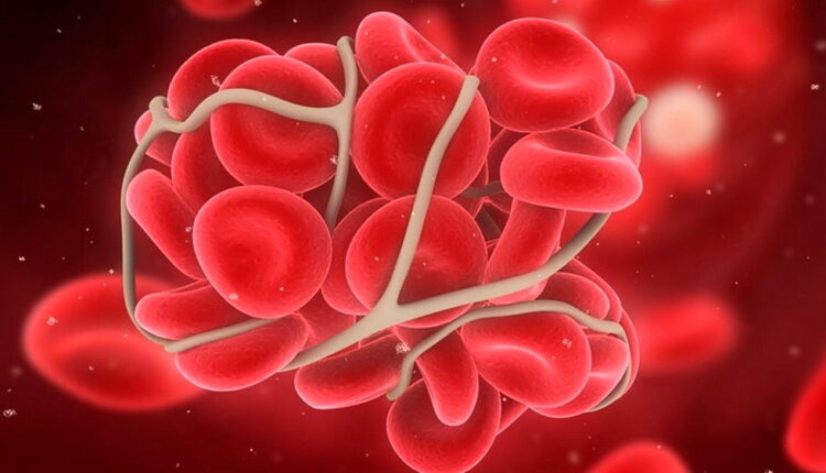 World Thrombosis Day - October 13