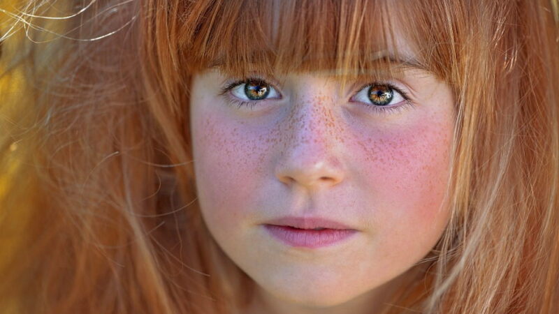 Love Your Freckles Day - November 22