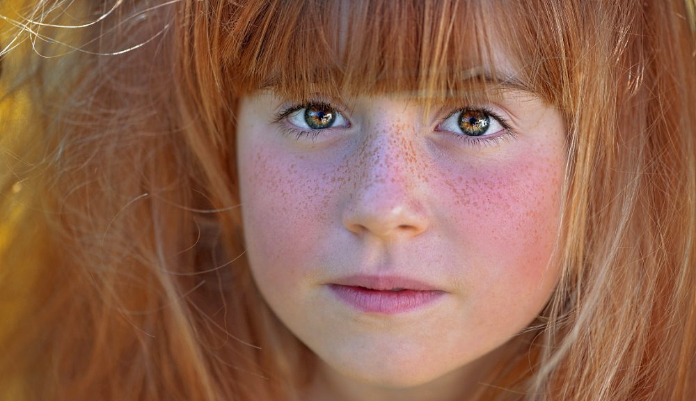 Love Your Freckles Day - November 22