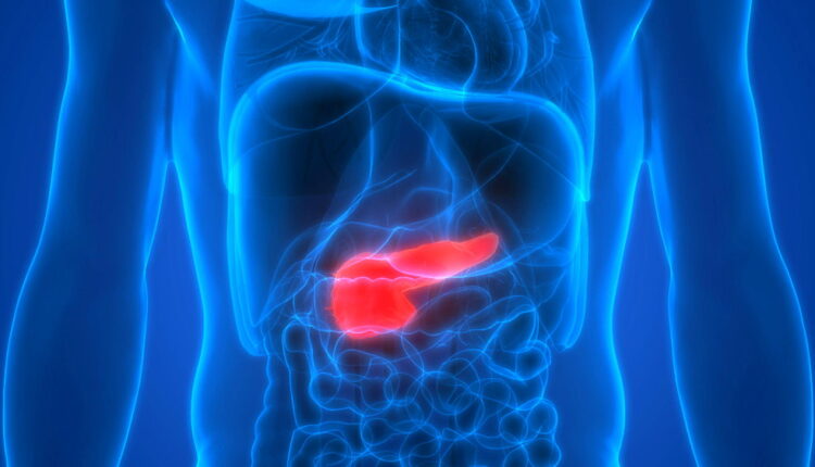 World Pancreatic Cancer Day - November 18