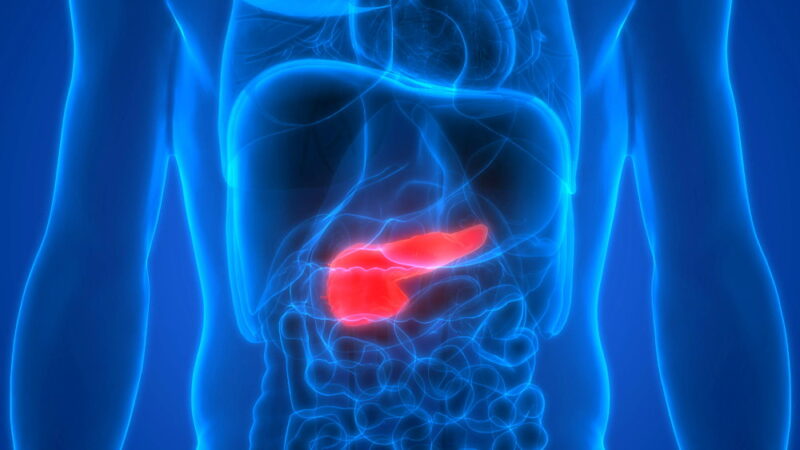 World Pancreatic Cancer Day - November 18